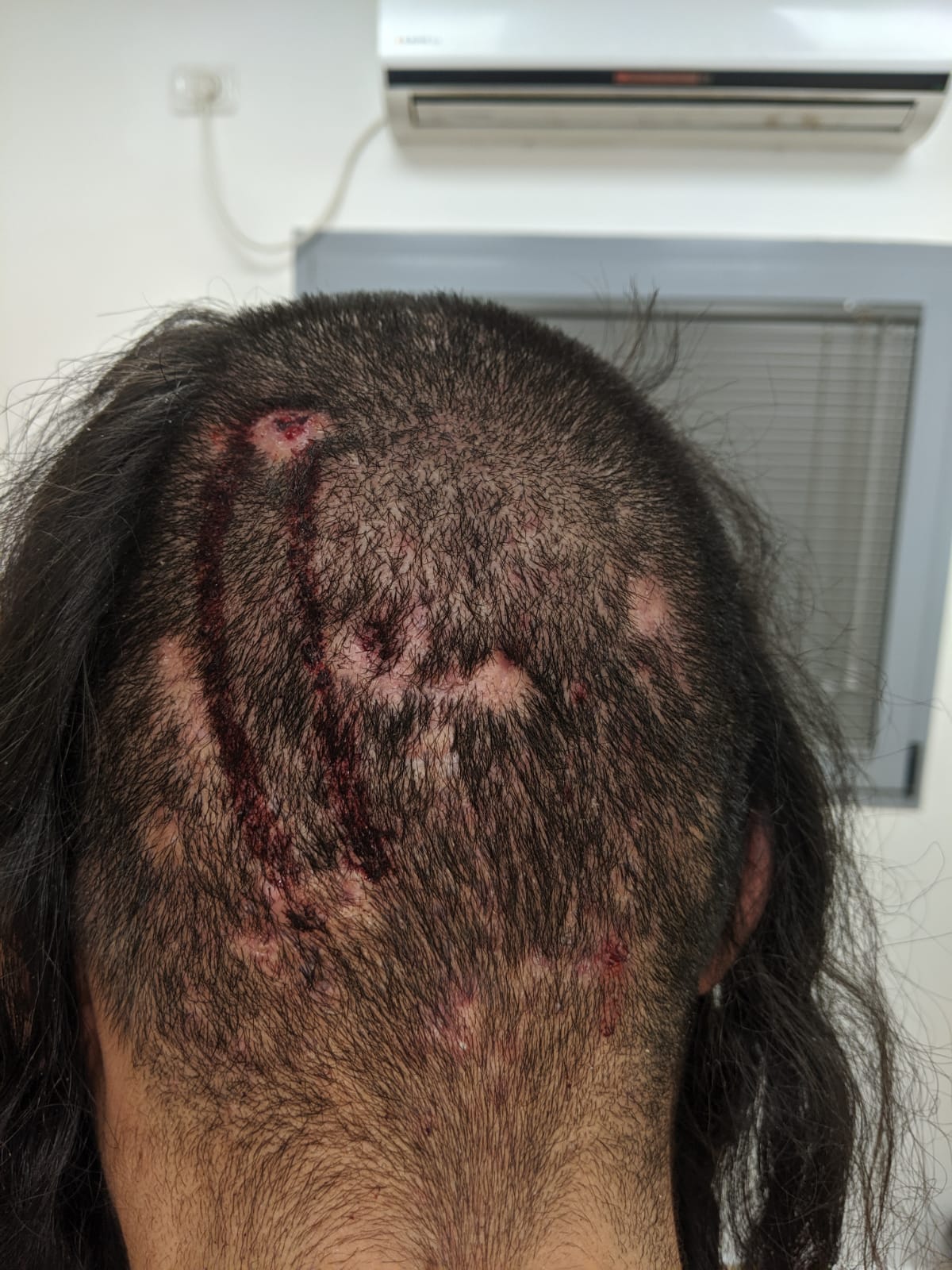 Neria Zarog's head injury